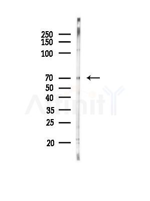 CEP70 Antibody - Western blot analysis of lysates from PC12 cells(LPS, 4h treatment), using CEP70 Antibody at 1/1000 dilution.