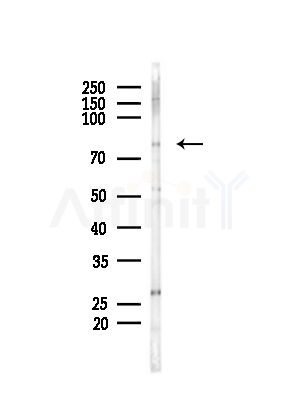 CEP78 Antibody - Western blot analysis of lysates from LoVo cells(heat-shock,45min treatment), using CEP78 Antibody at 1/1000 dilution.