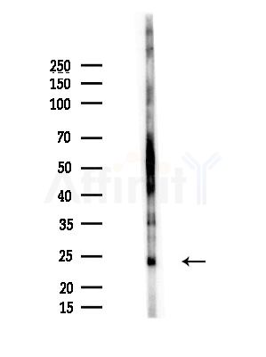 CBLN1 Antibody - Western blot analysis of lysates from Hela cells(heat-shock, 45min treatment), using CBLN1 Antibody at 1/1000 dilution.