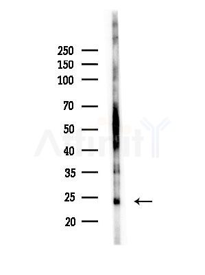CBLN1 Antibody - Western blot analysis of lysates from Hela cells(heat-shock, 45min treatment), using CBLN1 Antibody at 1/1000 dilution.