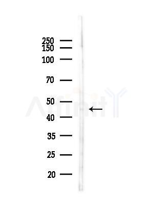CLN5 Antibody - Western blot analysis of lysates from LoVo cells(heat-shock,45min treatment), using CLN5 Antibody at 1/1000 dilution.