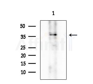 CLN6 Antibody - Western blot analysis of extracts from Rat testis, using CLN6 Antibody at 1/1000 dilution.
