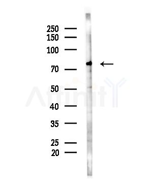 CNGA1 Antibody - Western blot analysis of lysates from A375 cells(starvation treatment), using CNGA1 Antibody at 1/1000 dilution.