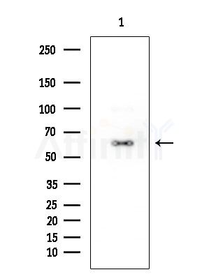 CLCC1 Antibody - Western blot analysis of extracts from EC304 cells, using CLCC1 Antibody at 1/1000 dilution.