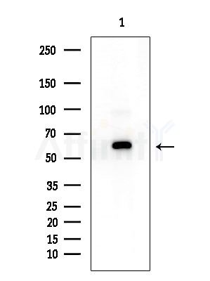 CLCC1 Antibody - Western blot analysis of extracts from A375 cells(starvation treatment), using CLCC1 Antibody at 1/1000 dilution.