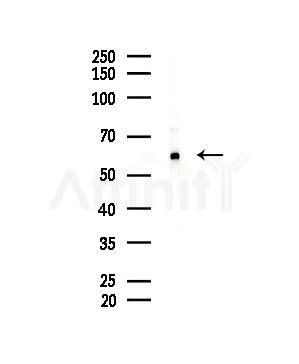 CLCC1 Antibody - Western blot analysis of lysates from A375 cells(starvation treatment), using CLCC1 Antibody at 1/1000 dilution.