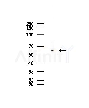 CLCC1 Antibody - Western blot analysis of lysates from EC304 cells, using CLCC1 Antibody at 1/1000 dilution.