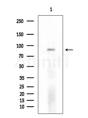 CLCN4 Antibody - Western blot analysis of extracts from Mouse testis, using CLCN4 Antibody at 1/1000 dilution.