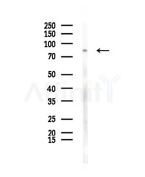 CLCN4 Antibody - Western blot analysis of lysates from Mouse testis, using CLCN4 Antibody at 1/1000 dilution.