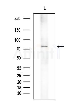 CLCN7 Antibody - Western blot analysis of extracts from A375 cells(starvation treatment), using CLCN7 Antibody at 1/1000 dilution.