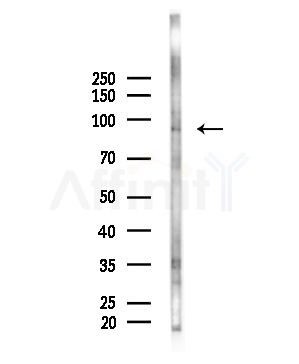 CLCN7 Antibody - Western blot analysis of lysates from A375 cells(starvation treatment), using CLCN7 Antibody at 1/1000 dilution.