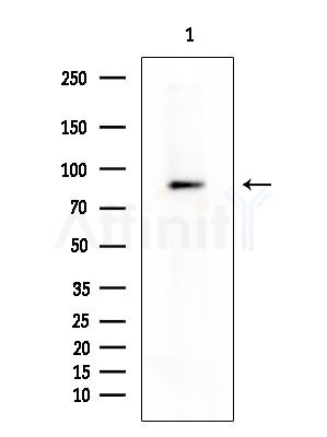 CLCNKA Antibody - Western blot analysis of extracts from Rat brain, using CLCNKA Antibody at 1/1000 dilution.