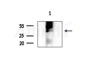 CLIC4 Antibody - Western blot analysis of extracts from PC12 cells(LPS 4h treatment), using CLIC4 Antibody at 1/1000 dilution.