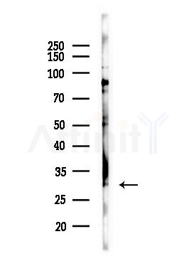 CLIC4 Antibody - Western blot analysis of lysates from PC12 cells(LPS,4h treatment), using CLIC4 Antibody at 1/1000 dilution.