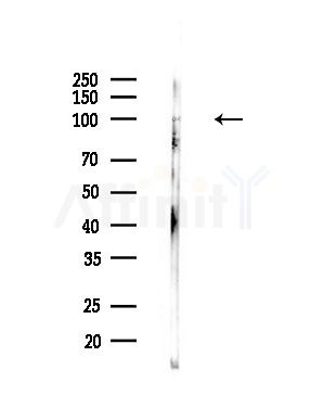 CHSY1 Antibody - Western blot analysis of lysates from PC12 cells(LPS,4h treatment), using CHSY1 Antibody at 1/1000 dilution.