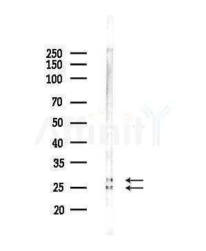 CKLF2 Antibody - Western blot analysis of lysates from Hela cells(starvation,24h treatment), using CKLF2 Antibody at 1/1000 dilution.