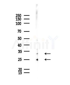 CKLF2 Antibody - Western blot analysis of lysates from Rat brain, using CKLF2 Antibody at 1/1000 dilution.