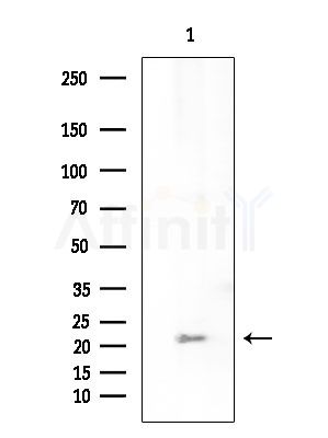 CKLF3 Antibody - Western blot analysis of extracts from Mouse testis, using CKLF3 Antibody at 1/1000 dilution.