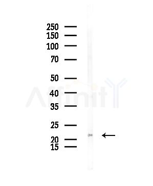 CKLF3 Antibody - Western blot analysis of lysates from Mouse testis, using CKLF3 Antibody at 1/1000 dilution.