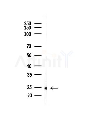 CKLF6 Antibody - Western blot analysis of lysates from COLO205 cells(heat-shock,45min treatment), using CKLF6 Antibody at 1/1000 dilution.