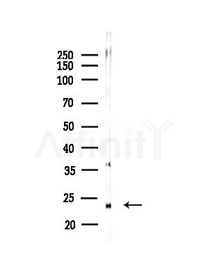 CKLF6 Antibody - Western blot analysis of lysates from Mouse testis, using CKLF6 Antibody at 1/1000 dilution.