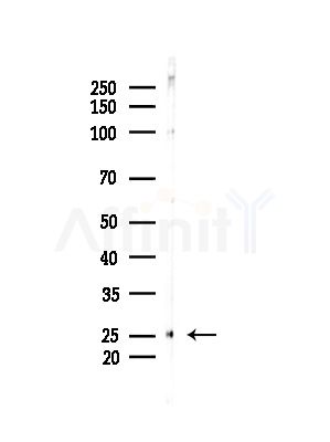 CKLF6 Antibody - Western blot analysis of lysates from MDA-MB-231 cells(heat-shock,45min treatment), using CKLF6 Antibody at 1/1000 dilution.