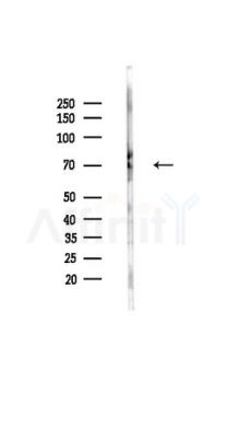 CSTF2T Antibody - Western blot analysis of lysates from HUVEC cells(UV,30min treatment), using CSTF2T Antibody at 1/1000 dilution.