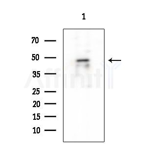 ST6GAL1 Antibody - Western blot analysis of extracts from Rat testis, using ST6GAL1 Antibody at 1/1000 dilution.