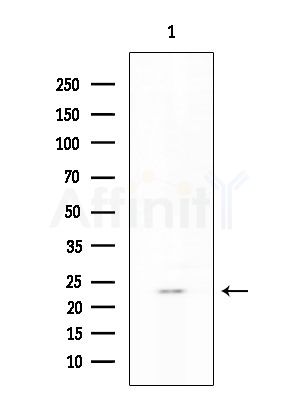 RCL Antibody - Western blot analysis of extracts from COLO205 cells, using RCL Antibody at 1/1000 dilution.