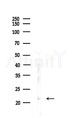 COPZ1 Antibody - Western blot analysis of lysates from EC304 cells, using COPZ1 Antibody at 1/1000 dilution.
