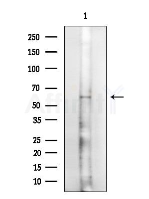 CCDC102A Antibody - Western blot analysis of extracts from Rat brain, using CCDC102A Antibody at 1/1000 dilution.