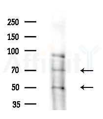 CCDC102B Antibody - Western blot analysis of extracts from HepG2 cells(LPS 4h treatment), using CCDC102B Antibody at 1/1000 dilution.
