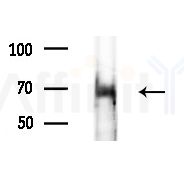 CCDC102B Antibody - Western blot analysis of extracts from Hela cells, using CCDC102B Antibody at 1/1000 dilution.