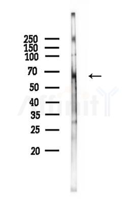 CCDC102B Antibody - Western blot analysis of lysates from Hela cells, using CCDC102B Antibody at 1/1000 dilution.