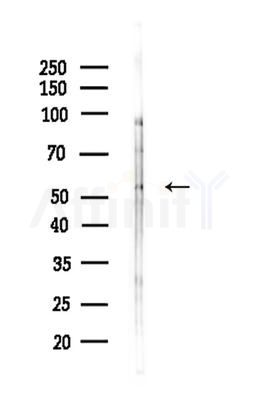 CCDC102B Antibody - Western blot analysis of lysates from HepG2 cells(LPS 4h treatment), using CCDC102B Antibody at 1/1000 dilution.