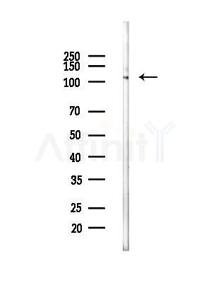 C6 Antibody - Western blot analysis of lysates from Rat brain, using C6 Antibody at 1/1000 dilution.