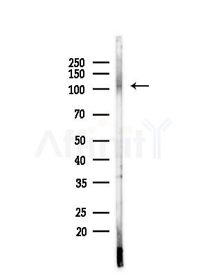 NCAPG Antibody - Western blot analysis of lysates from LoVo cells(heat-shock,45min treatment), using NCAPG Antibody at 1/1000 dilution.
