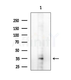 CCS/SOD4 Antibody - Western blot analysis of extracts from RAW264.