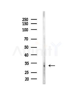 CCS/SOD4 Antibody - Western blot analysis of lysates from RAW264.