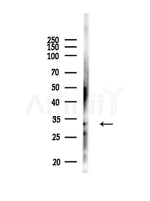HSD11B1 Antibody - Western blot analysis of lysates from RAW264.