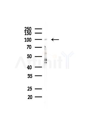 CNGB1 Antibody - Western blot analysis of lysates from COLO205 cells(heat-shock,45min treatment), using CNGB1 Antibody at 1/1000 dilution.