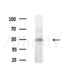 DKK3 Antibody - Western blot analysis of extracts from HepG2 cells(heat-shock,45min treatment), using DKK3 Antibody at 1/1000 dilution.