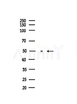 CRMP3 Antibody - Western blot analysis of lysates from PC12 cells(starvation,24h treatment), using CRMP3 Antibody at 1/1000 dilution.