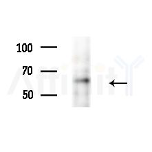 RPC3 Antibody - Western blot analysis of lysates from HepG2 cells(heat-shock,45min treatment), using RPC3 Antibody at 1/1000 dilution.