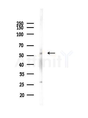 TESK1 Antibody - Western blot analysis of lysates from RAW264.