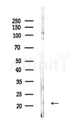 DNAL1 Antibody - Western blot analysis of lysates from HepG2 cells(LPS 4h treatment), using DNAL1 Antibody at 1/1000 dilution.