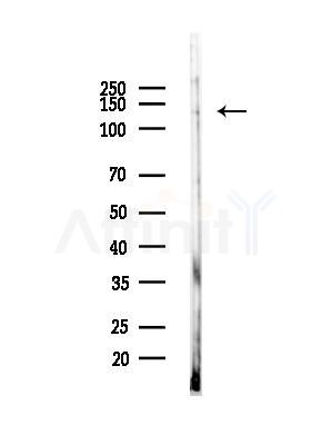 DZIP3 Antibody - Western blot analysis of lysates from Rat brain, using DZIP3 Antibody at 1/1000 dilution.