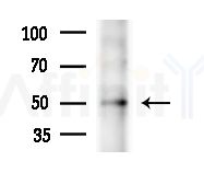 MYLIP Antibody - Western blot analysis of lysates from B16F10-LUC cells
(heat-shock treatment), using MYLIP Antibody at 1/1000 dilution.
