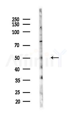 MYLIP Antibody - Western blot analysis of lysates from B16F10-LUC cells(heat-shock,45min treatment), using MYLIP Antibody at 1/1000 dilution.