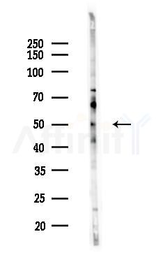 MYLIP Antibody - Western blot analysis of lysates from HepG2 cells(heat-shock,45min treatment), using MYLIP Antibody at 1/1000 dilution.